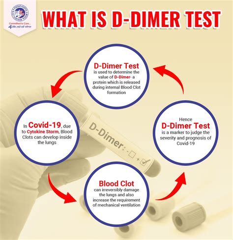 d dimer test blood bottle|d dimer nhs guidelines.